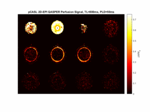 Multi-PLD ASL Acquisition